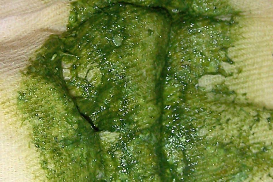 Hijau terang
