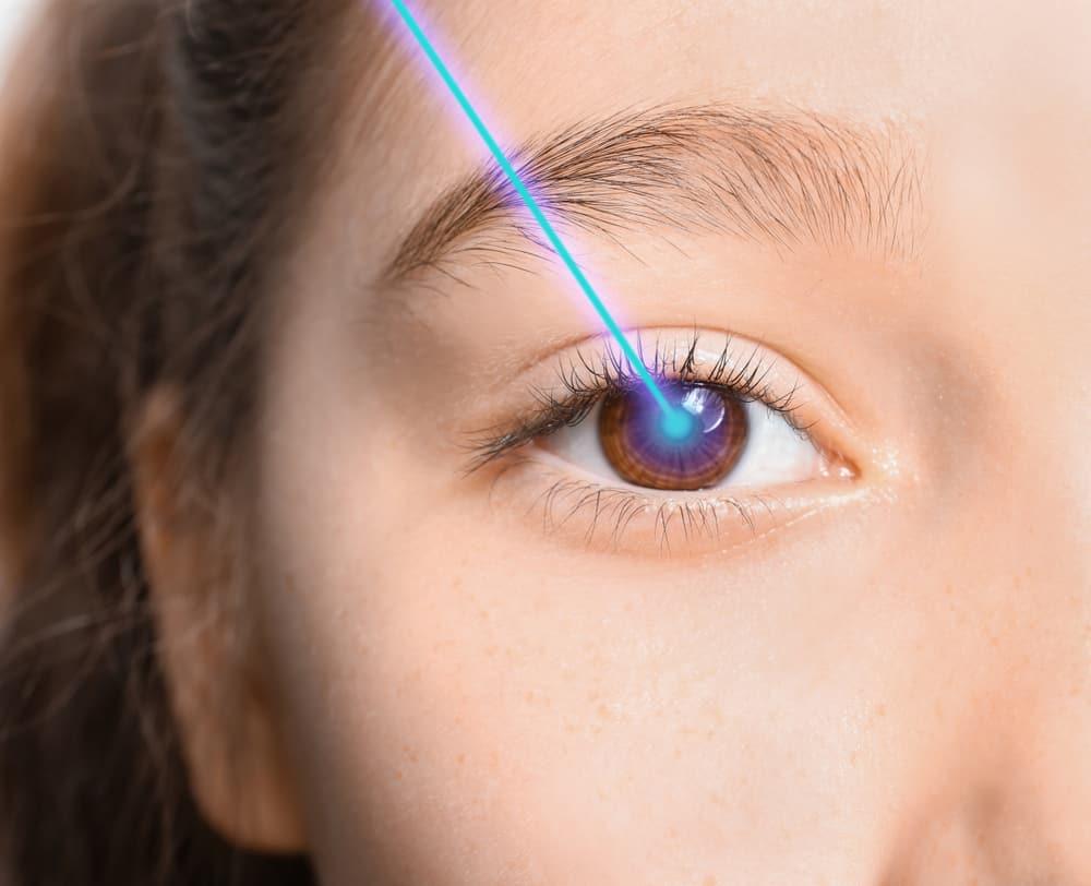 Sebelum Operasi LASIK, Perhatikan Dulu Hal Berikut Ini!