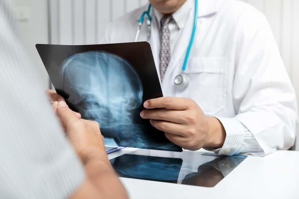 harapan-hidup-kanker-otak