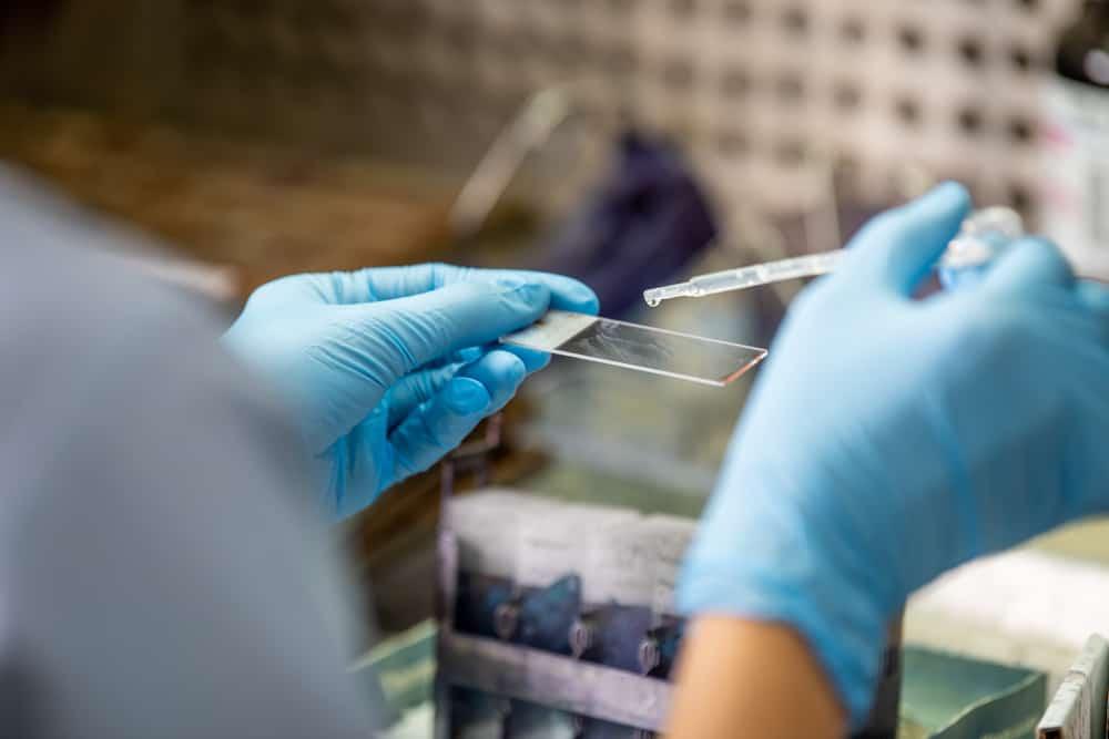 Tes Dahak BTA, Salah Satu Metode Pemeriksaan TBC