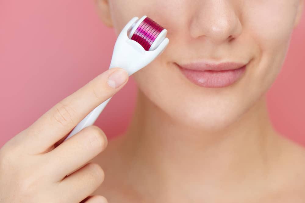 Microneedling