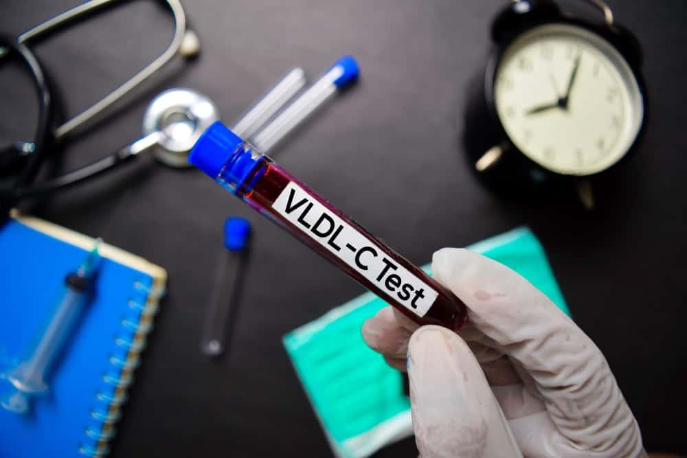 perbedaan-vldl-dan-ldl-pada-kolesterol