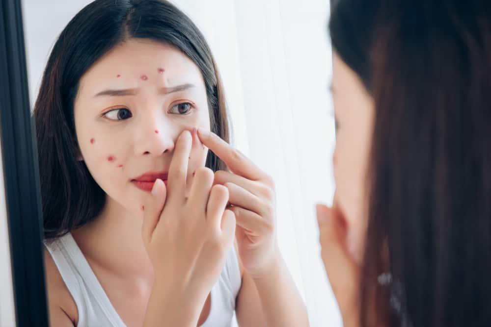 Mengulik Kelebihan Hormon Androgen pada Wanita yang Perlu Diwaspadai
