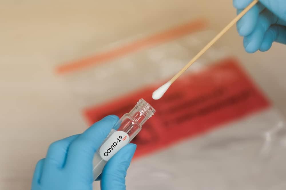 virus-corona-covid-19-sars-cov-2