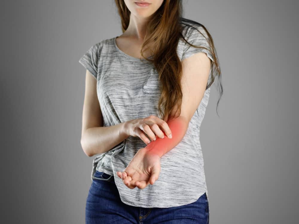 6 Gejala Scabies (Kudis) serta Tanda-Tanda Sembuhnya