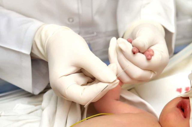 Mengenal Kelebihan Sel Darah Putih pada Bayi