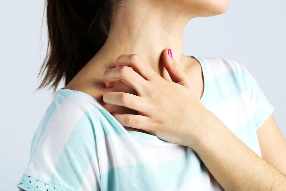 mencegah-alergi-kulit