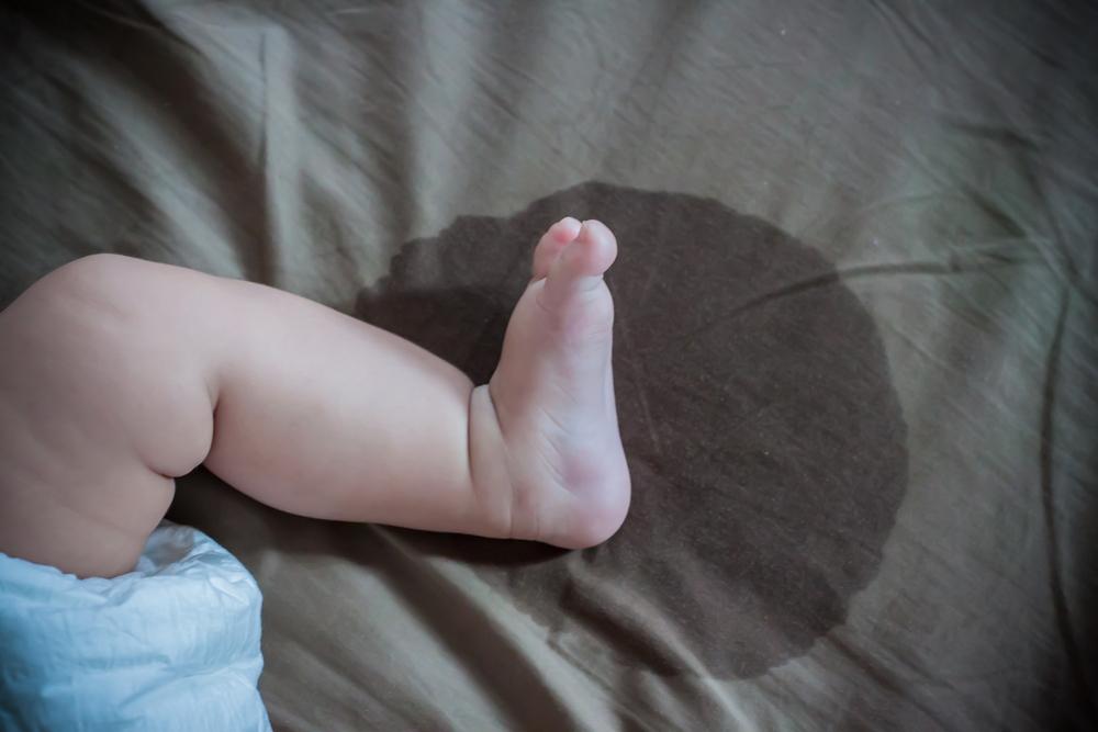 Bayi Ibu Jarang Pipis? Yuk, Ketahui Penyebabnya!