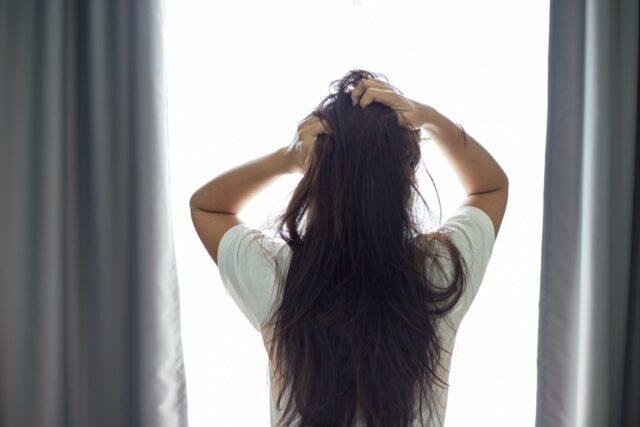 kulit-kepala-mengelupas