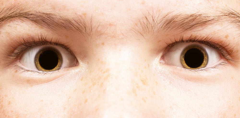 midriasis