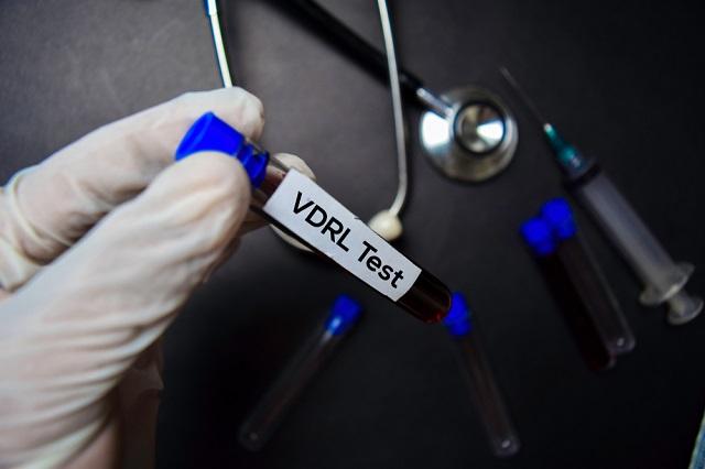 tes-vdrl