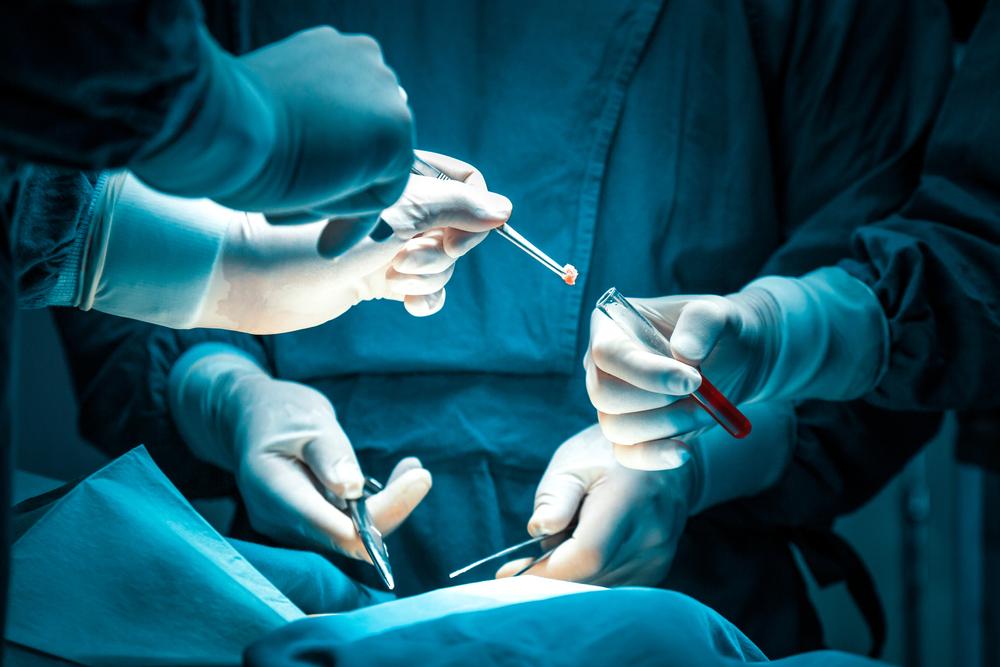 mediastinoscopy