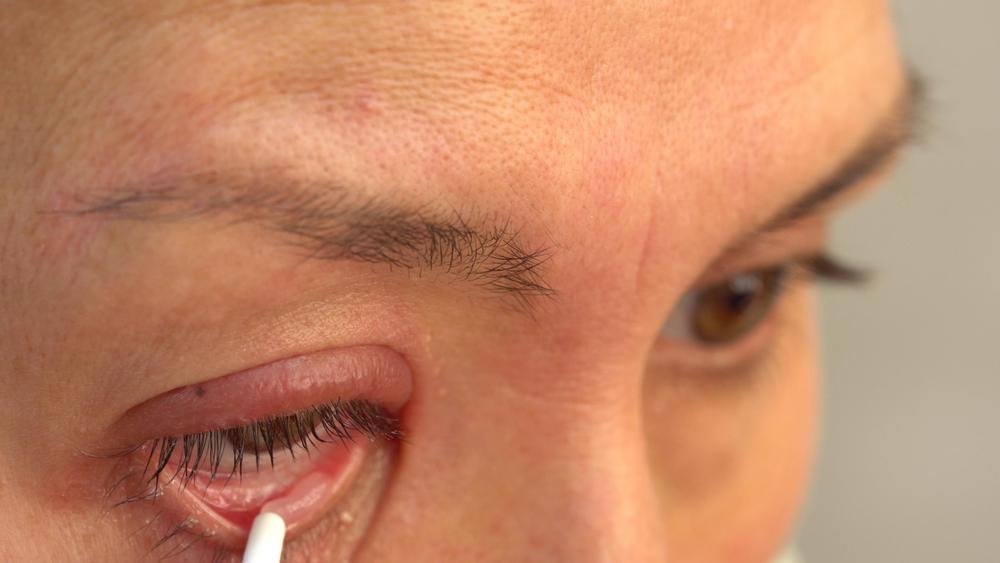 cara-pakai-salep-mata