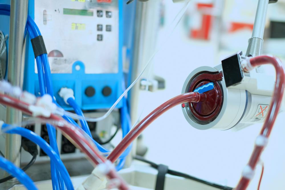 Mengulik Penggunaan ECMO, Mesin yang Membantu Kerja Jantung dan Paru-Paru Bayi