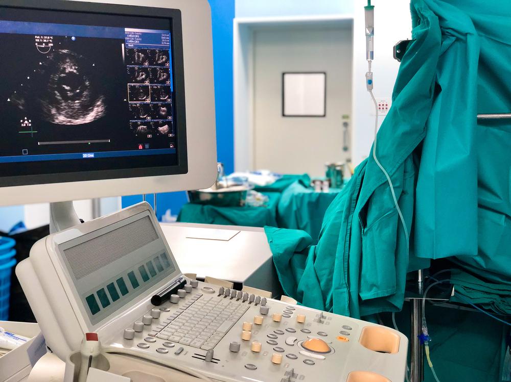 transesophageal-echocardiogram