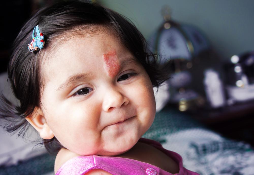 Operasi Hemangioma pada Bayi, Prosedur Pengangkatan Pertumbuhan Pembuluh Darah