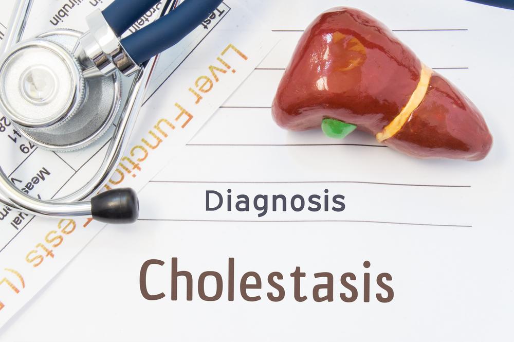 kolestasis