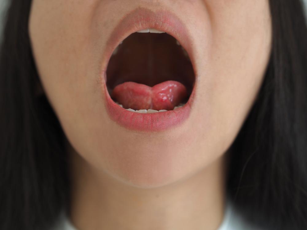 Lidah Tertelan
