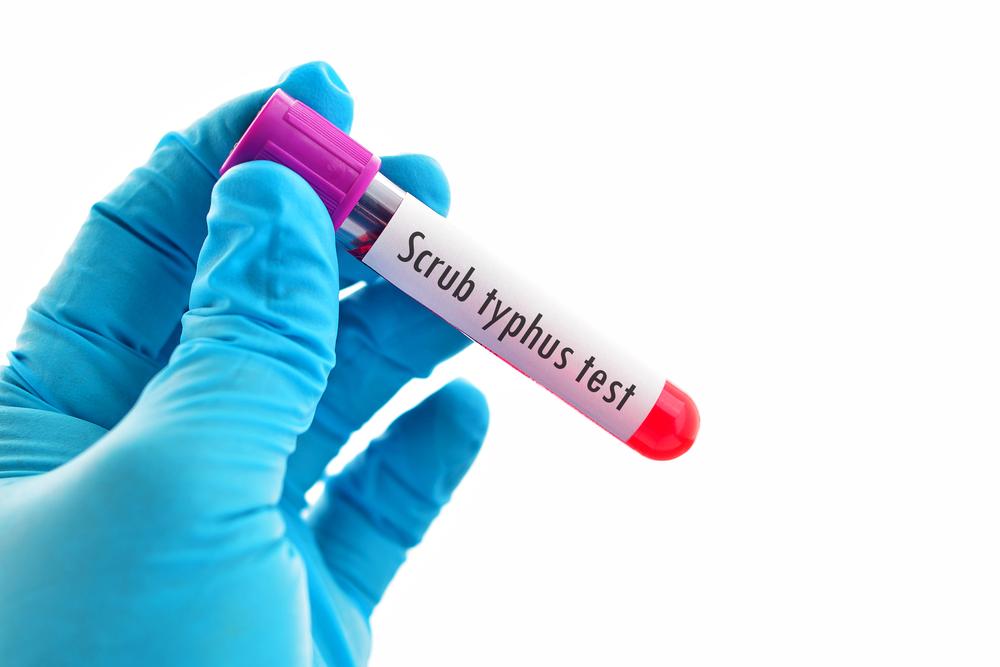 Mengenal Scrub Typhus, Jenis Tifus yang Disebabkan Larva Kutu