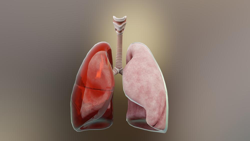 beda-emfisema-dan-empiema