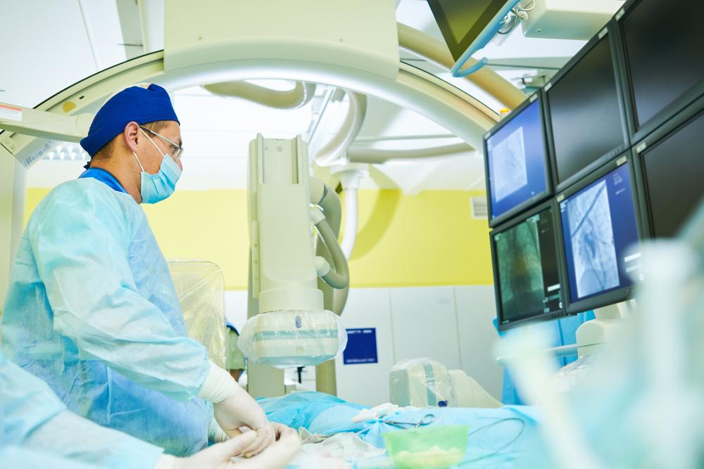 Angiografi Jantung untuk Mendeteksi Penyumbatan Arteri