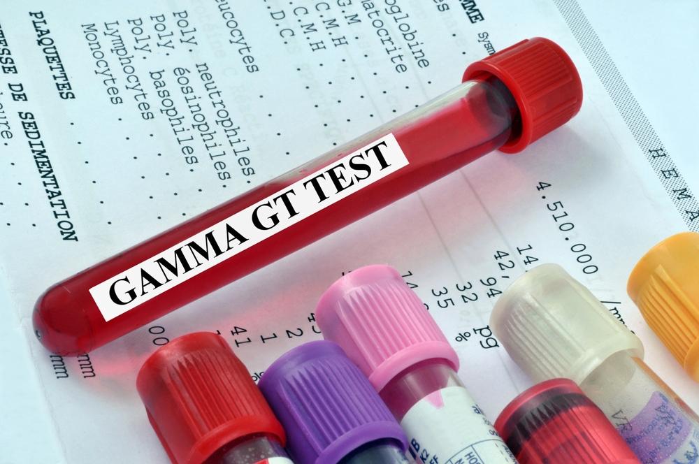 tes-gamma-gt