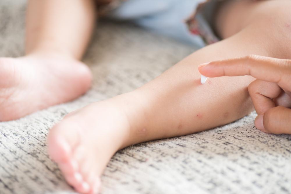 rekomendasi-lotion-anti-nyamuk-untuk-bayi