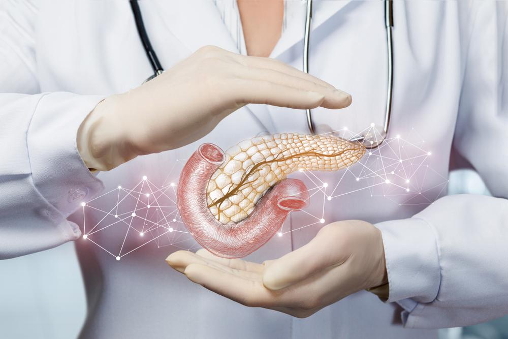 islet-transplantation