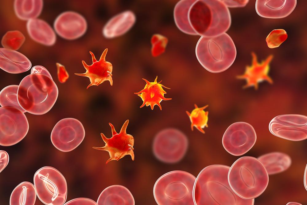 Bernard-Soulier Syndrome, Kelainan pada Trombosit Darah