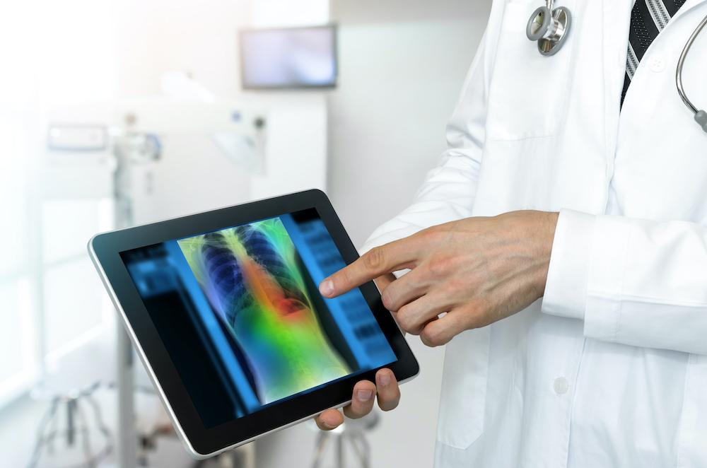 Deteksi Dini dan Telehealth Mentoring Program Kanker Nasional