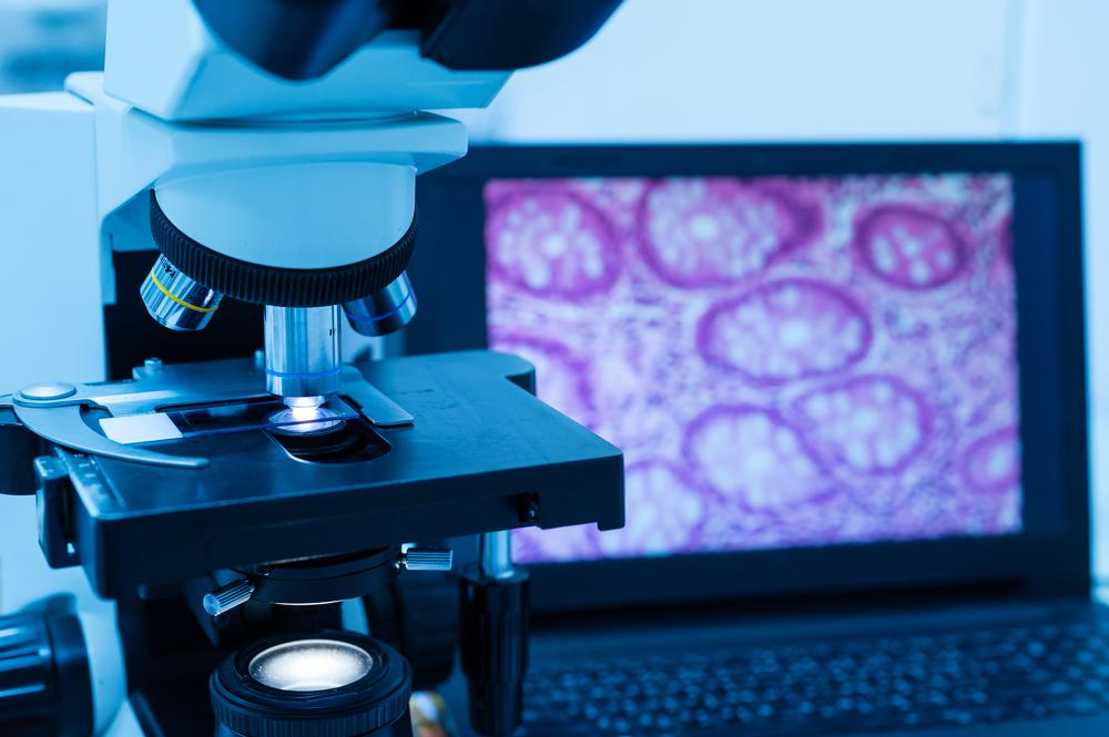 Mengenal Peran Dokter Spesialis Patologi