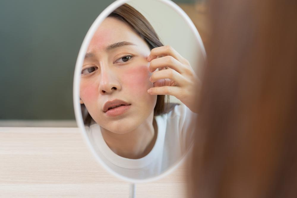 Tanda Alergi Kosmetik, Apa Saja yang Harus Diwaspadai?