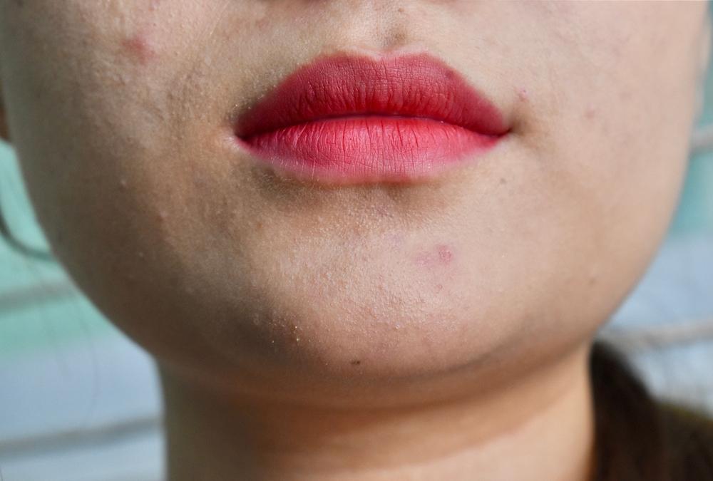 5 Skincare Tepat untuk Atasi Kulit Kering, Kusam, dan Beruntusan