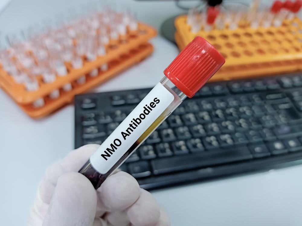neuromyelitis-optica