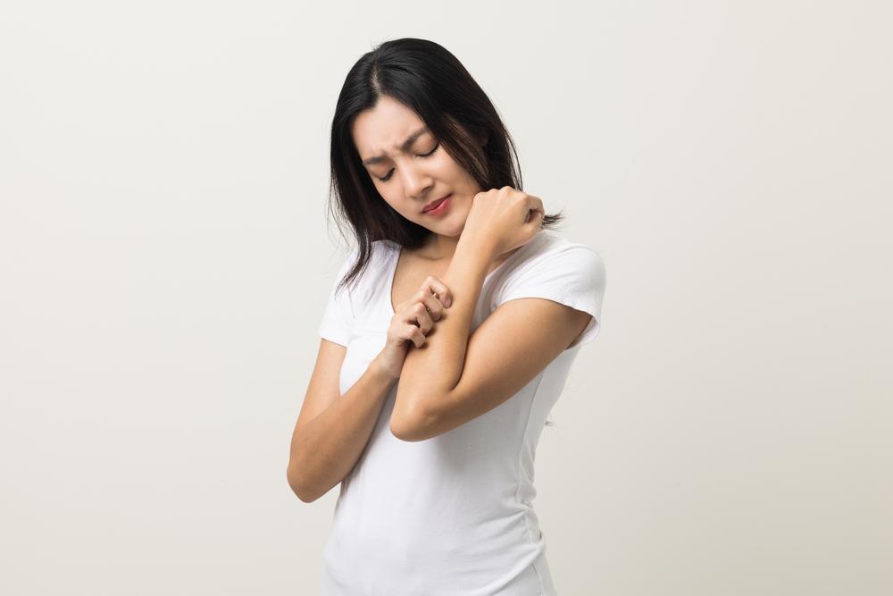 rekomendasi-merek-obat-salep-gatal