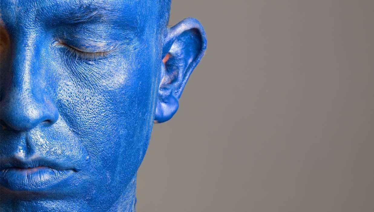 Argyria
