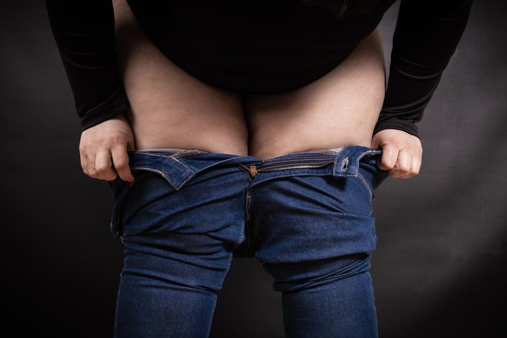 Lipedema, Penumpukan Lemak Tak Normal yang Harus Diwaspadai