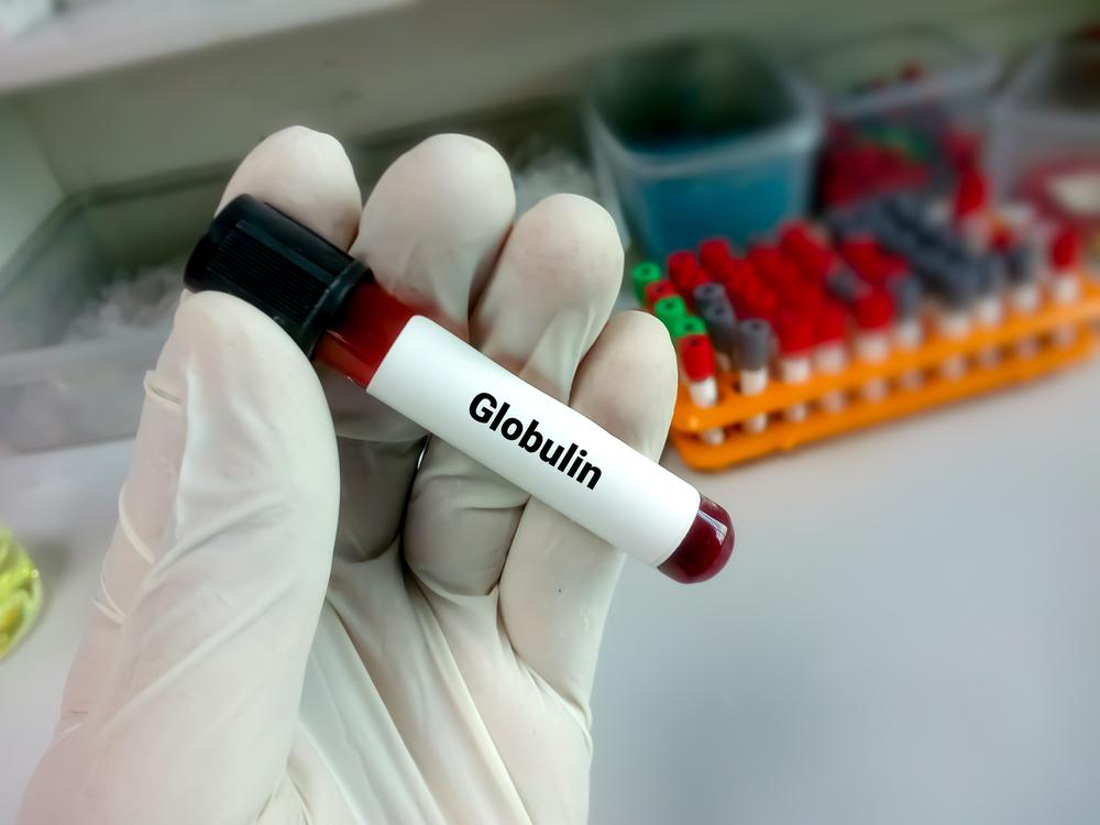 globulin