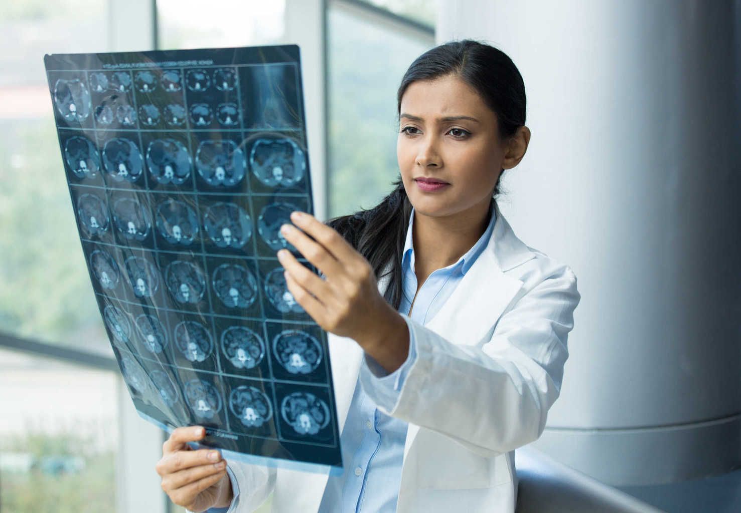 Mengetahui Pembuluh Darah Mana yang Dipengaruhi oleh Stroke