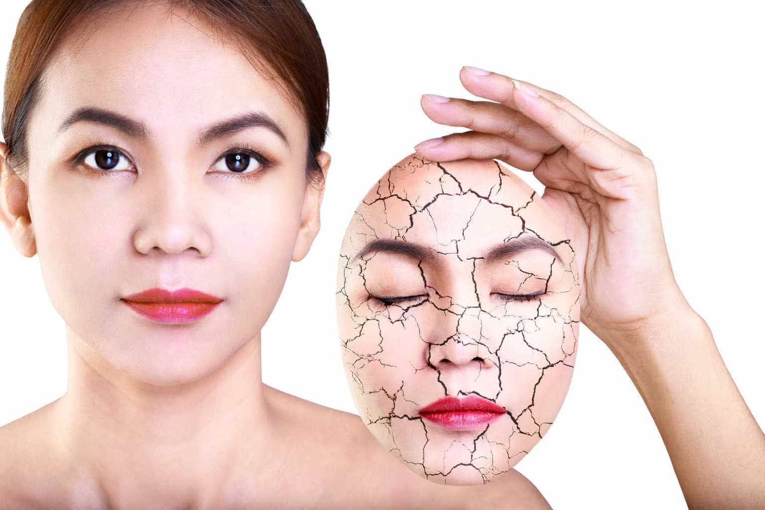 5 Ramuan Alami untuk Mengatasi Kulit Kering