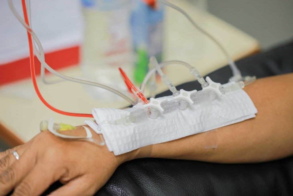 Trombolisis Intra-Arterial untuk Pengobatan Stroke